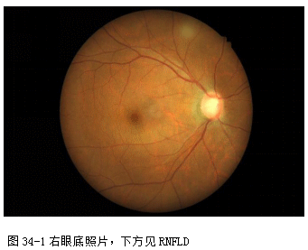 ZY016_175_2.gif
